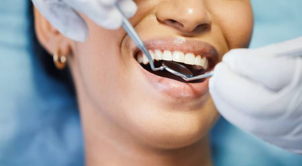 Best Emergency Wisdom Teeth Removal in Berea, OH