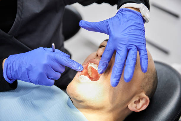 Best Emergency Broken Tooth Repair in Berea, OH